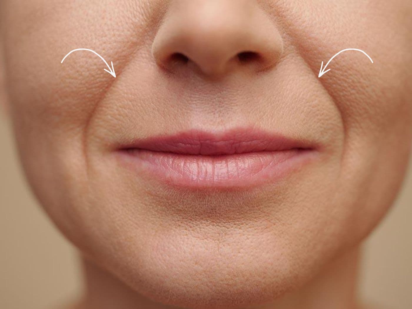 Armonización Facial Integral