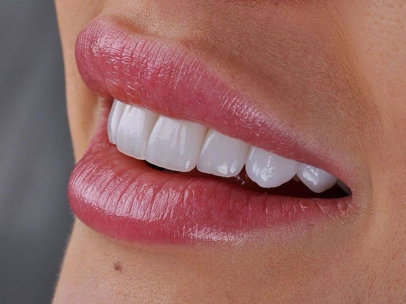 Estética Dental y Diseño de Sonrisa